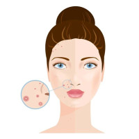 Сонцезахисний ультралегкий і ультрастійкий Ля Роше, La Roche-Posay Anthelios