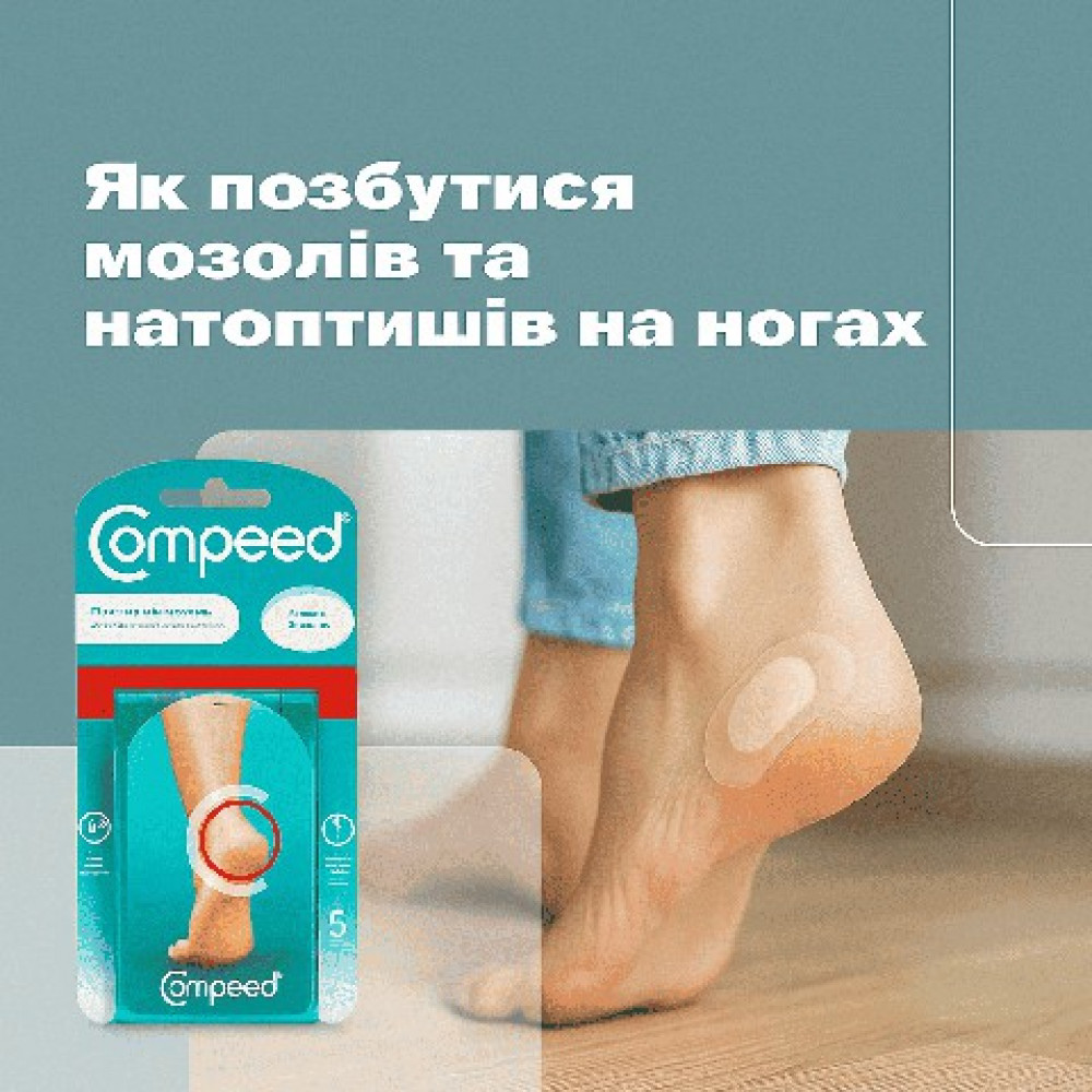 Как избавиться от мозолей и натоптышей на ногах