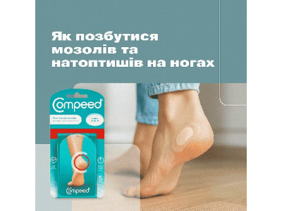 Як позбутися мозолів та натоптишів на ногах